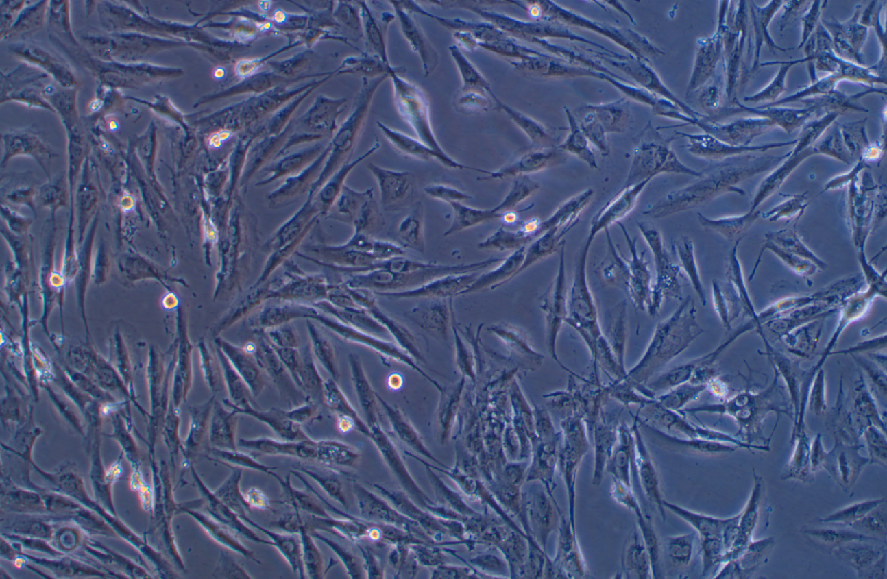 人脑星形胶质细胞瘤细胞SW1088 (STR鉴定正确)