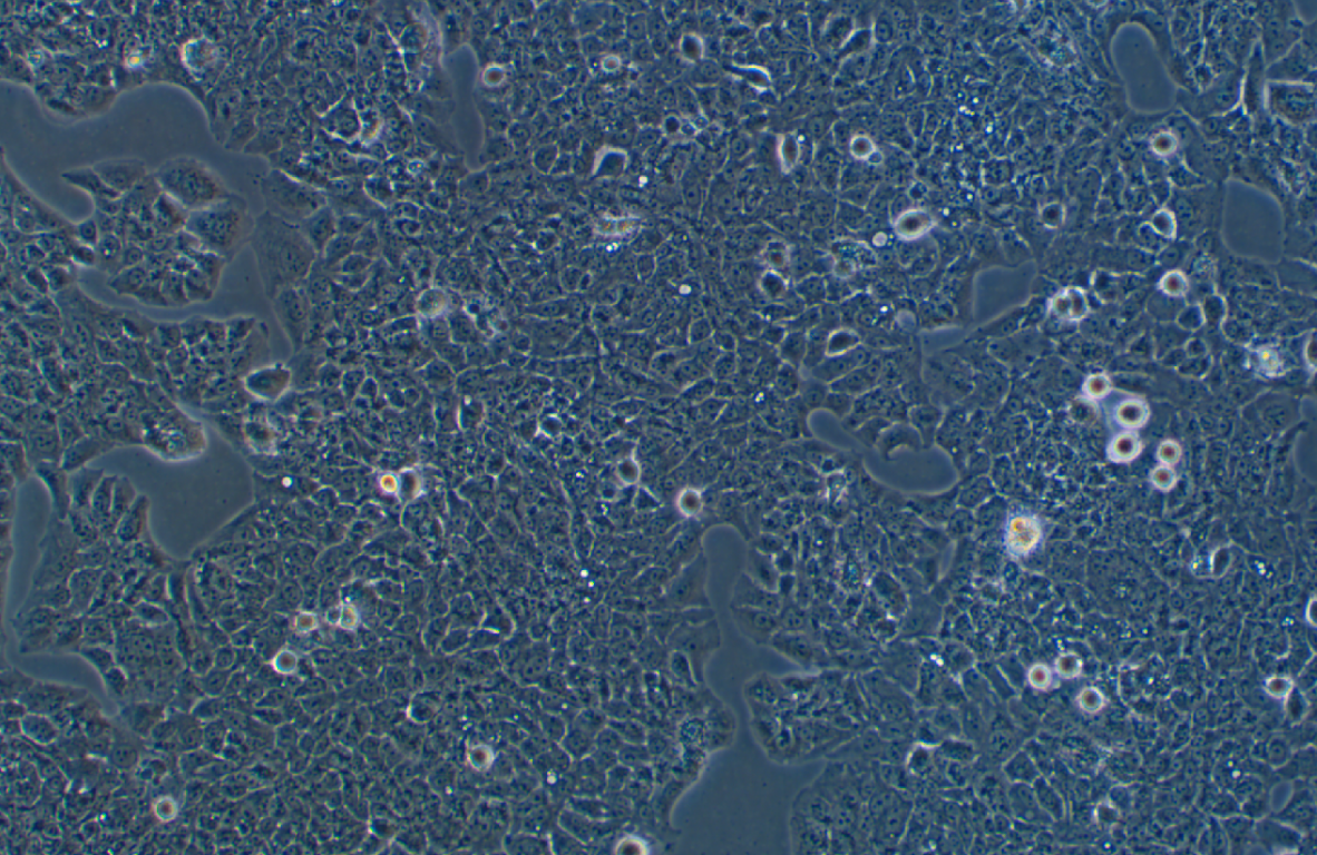 人子宫颈表皮癌细胞MS751(STR鉴定正确)